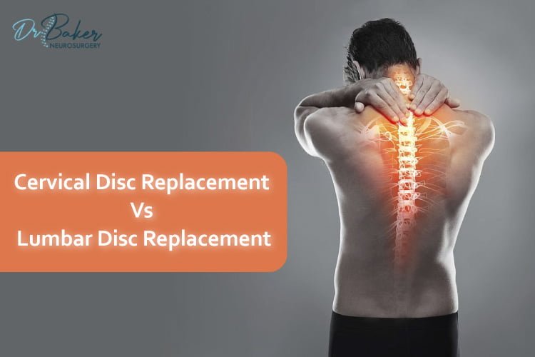 Differences Between Cervical Disc Replacement and Lumbar Disc Replacement