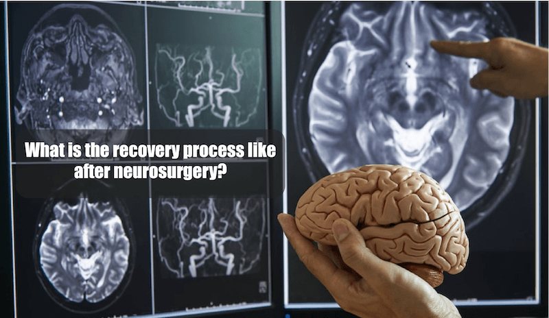 What Is The Recovery Process Like After Neurosurgery?