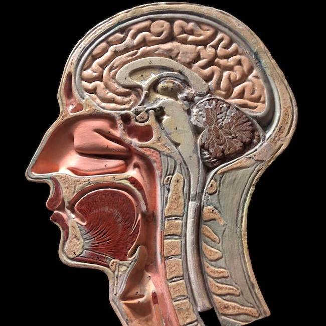 Hormone Called Melatonin Pineal Gland Parietal Lobe Cerebrospinal Fluid Difficulty Walking Vomiting Fatigue Eye Pain Nearby Tissue Older Adults Side Of The Body Speech Problems Seizures Doctor Weakness Worse