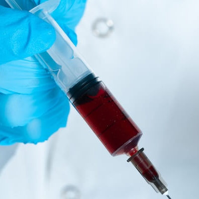 Platelet Rich Plasma Injections Prp Injections Plasma Rich Plasma Treatment White Blood Cells Articular Cartilage Patients Knees Pathologic Processes Musculoskeletal Conditions J Cell Physiol Clin J Sport Med Sports Med J Sports Med Placebo Treatment